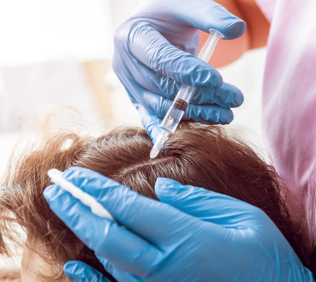 Stem cell transplants may encourage new hair growth