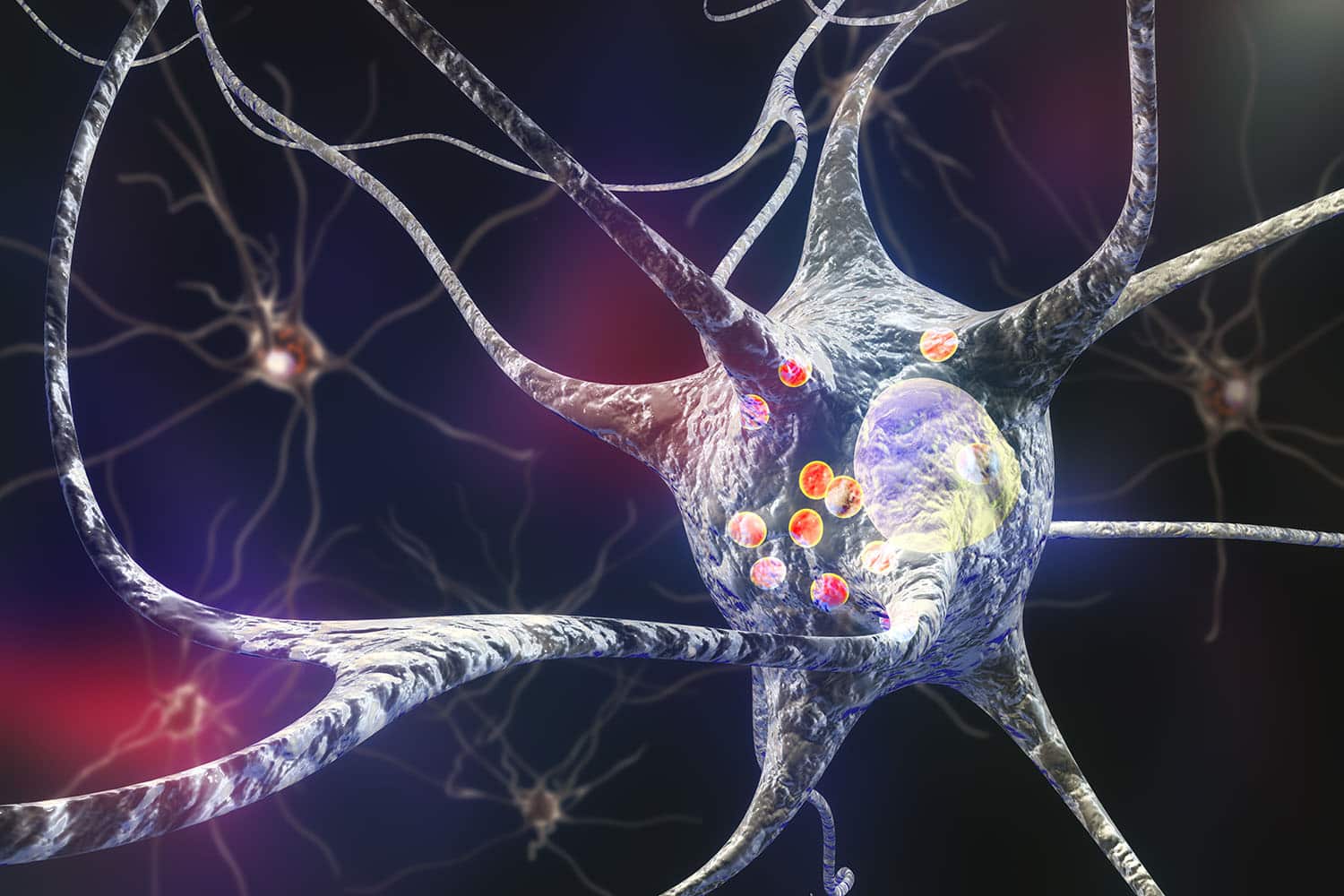 Treating Neurological Diseases with Stem Cells - Stem Cells LA