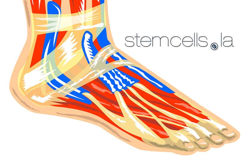 Is Peripheral Neuropathy Stem Cell Treatment Possible?