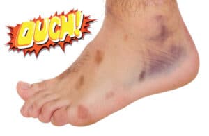 Neuropathy Stem Cell Therapy in Los Angeles