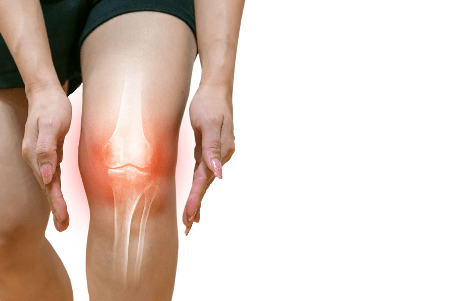 Injured tissue and knee osteoarthritis from cartilage defects may be treated with targeted stem cell injections