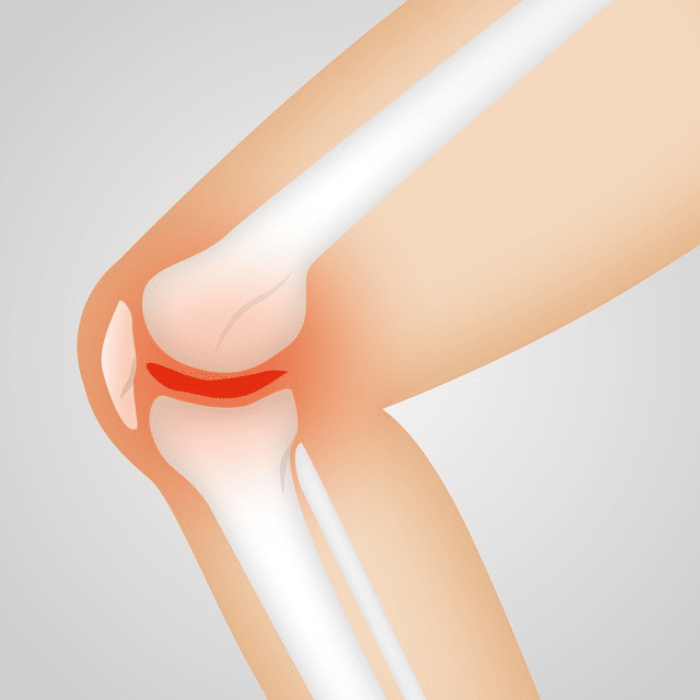 Knee injuries may cause pain and impeed proper joint function