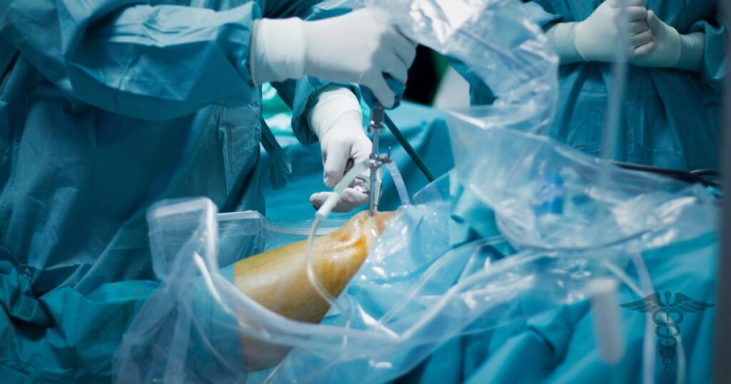 Knee replacement surgery, severe treatment