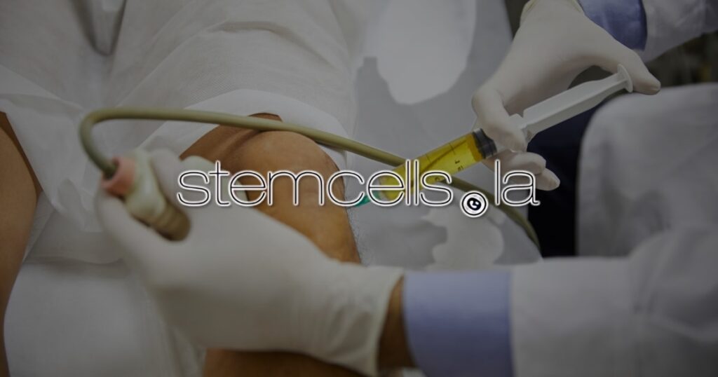 Stem Cells LA, Discuss stem cell Therapy, non invasive knee repair