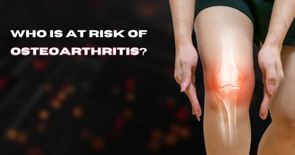 Research on osteoarthritis, arthritis foundation (understanding): Who is at risk