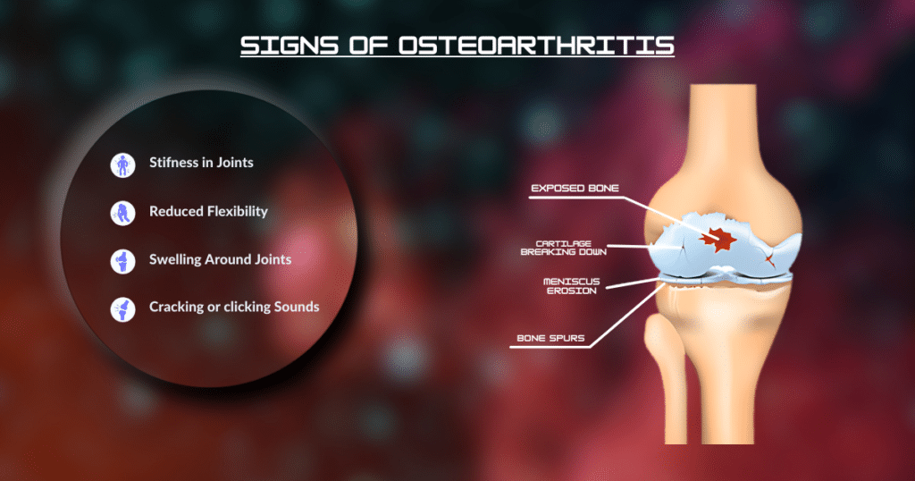 Identify to Treat Osteoarthritis, joint stiffness