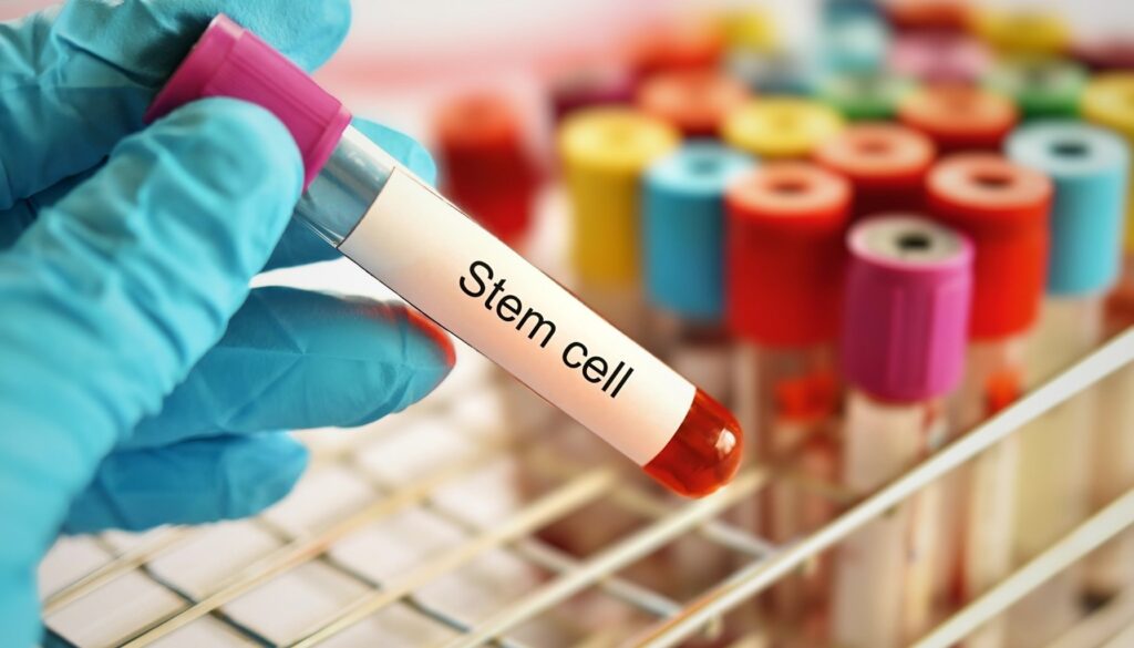 Stem Cell Therapy Services