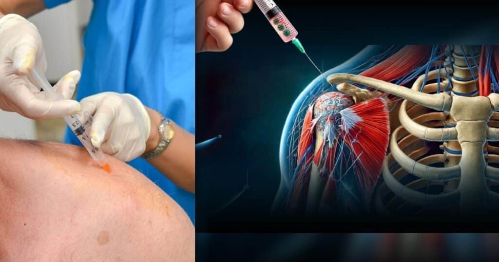 Patient receiving a stem cell injection in a clinical setting, showcasing the procedure.