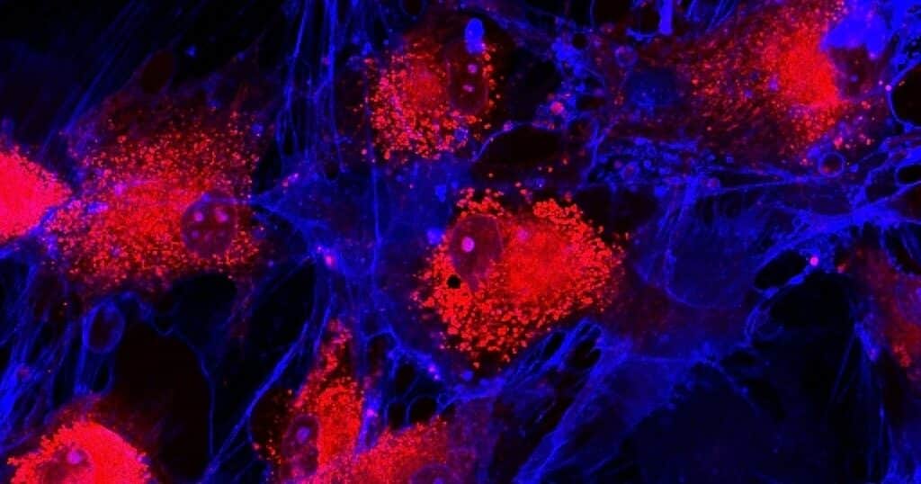 Full image of Mesenchymal Stem Cells (MSC's)