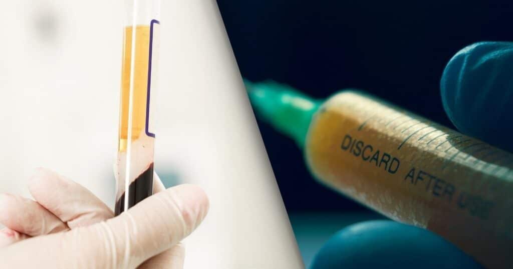 Split image of Stem cell injection and platelet rich plasma syringes