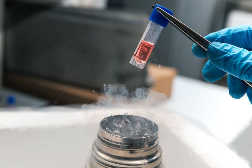 donor Stem Cell container being taken out of cryogen to be used for stem cell injection therapy