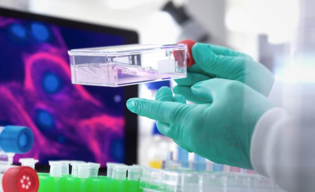 Image of a stem cell doctor holding a dish of mesenchymal stem cells